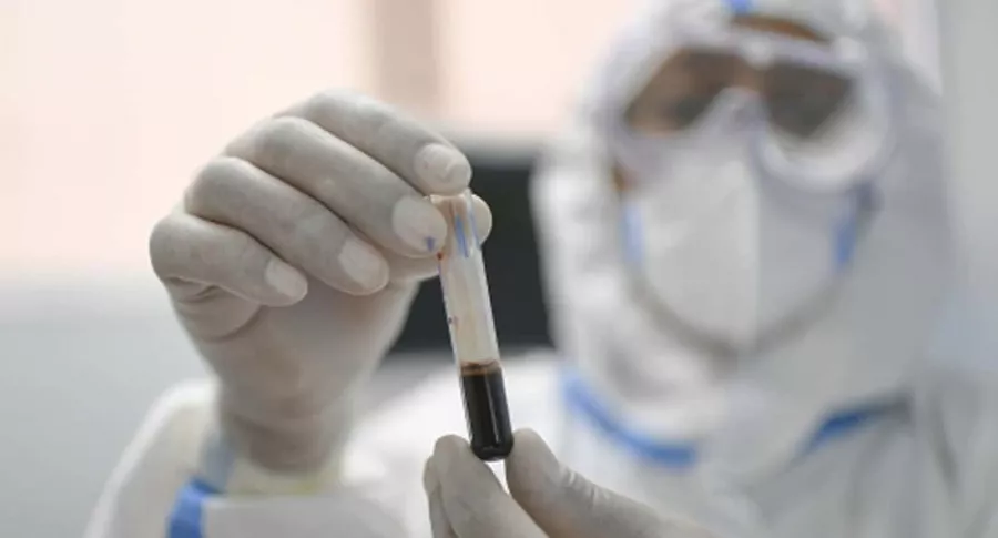 Prueba de laboratorio, ilustra nota de Venezuela que ya presentó a OMS medicina que "anula" al coronavirus
