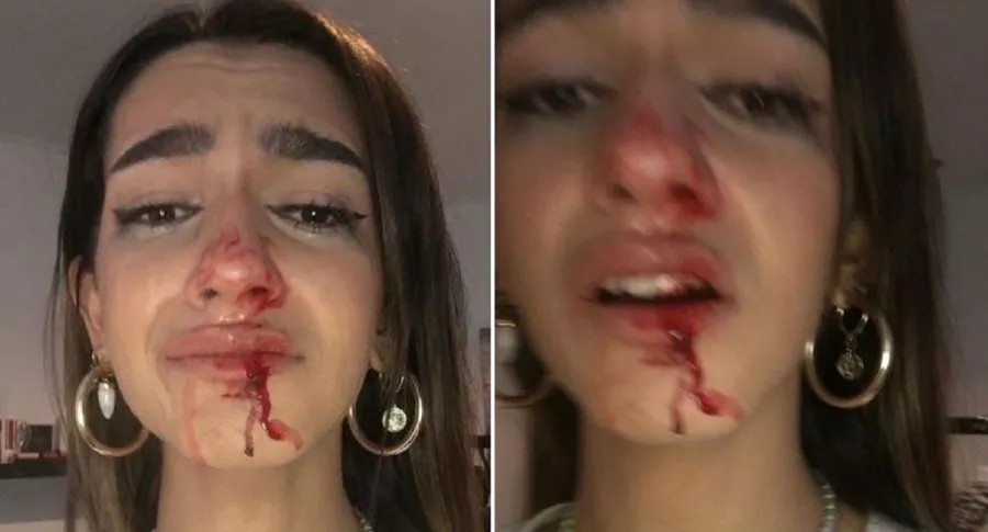 Eva Castt, una joven transexual de 19 años, recibió una brutal golpiza en plena calle de Barcelona, España