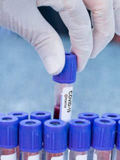 Pruebas de coronavirus, ilustran nota de Coronavirus en Colombia: nuevos casos y muertes hoy, noviembre 21