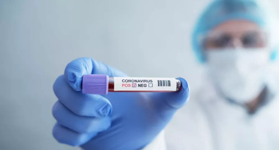 Examen de sangre para coronavirus para ilustrar nota sobre un año del primer caso confirmado de COVID-19 en China