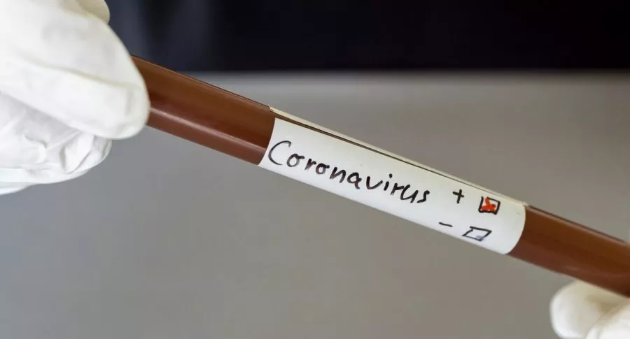 Toma de muestra de coronavirus, a propósito de los casos en Colombia 