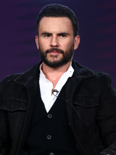 Foto de Juan Pablo Raba, quien tuvo problema en el rostro debido a tratamiento estético.