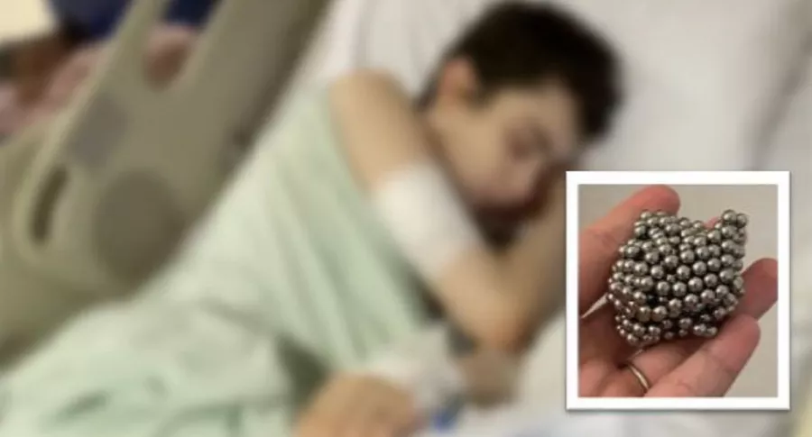 Rhiley Morrison, de 12 años, fue operado luego de comerse 54 imanes para volverse 'magnético’. El hecho se registró en Manchester (Reino Unido).