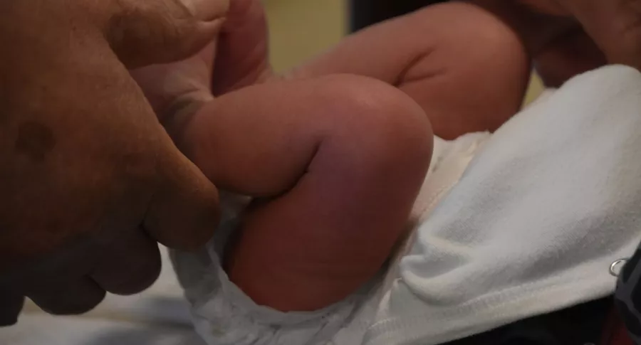 Piernas de bebé ilustran nota de menor quemado durante circuncisión 
