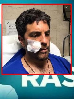 Elenco de Enfermeras y César Manzano, actor de la serie que recibió un disparo en la cara durante robo en Bogotá