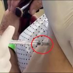 [Video] Enfermera simuló vacunar a adulta mayor con jeringa vacía y nieta se dio cuenta