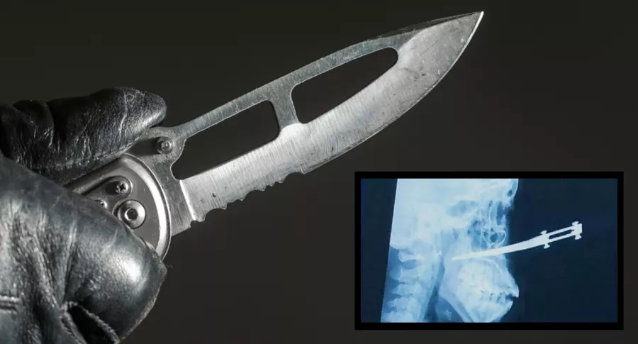 Imagen de cuchillo que ilustra nota; en Cartagena, una mujer terminó con arma blanca incrustada en cara durante un atraco