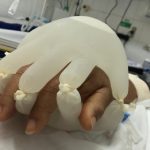 Enfermera diseña ‘mano’ con guantes para que pacientes con COVID no se sientan solos
