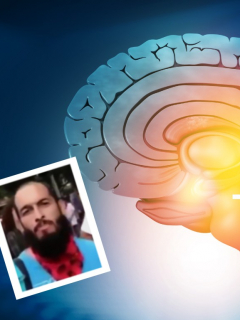 Fotos de cerebro y de Lucas Villa, a propósito de qué es muerte cerebral, diagnóstico que darían al joven herido en paro en Pereira.