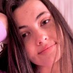 Como para morirse de sed: joven es alérgica a tomar agua y a sudar, pues le salen ronchas