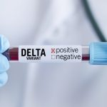 Venezuela también confirma primeros pacientes con variante Delta del COVID-19