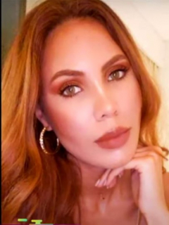 A ex Señorita Bogotá le cayó un dron encima y le desfiguró la cara, video