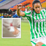 [Video] Jugadora de Nacional se calentó y le pegó puño a rival; tuvo que ser operada
