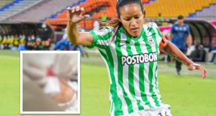 Lady Andrade, jugadora de Atlético Nacional, le pegó puño en la cara a Carolina Pineda en el partido ante América de Cali por la Liga BetPlay Femenina. 