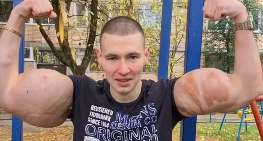 A Kirill Tereshin, el popeye ruso, se le revienta brazo en plena pelea. Imagen del pegador.
