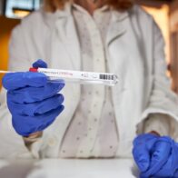 Coronavirus en Colombia nuevos casos y muertes 2 diciembre 2021