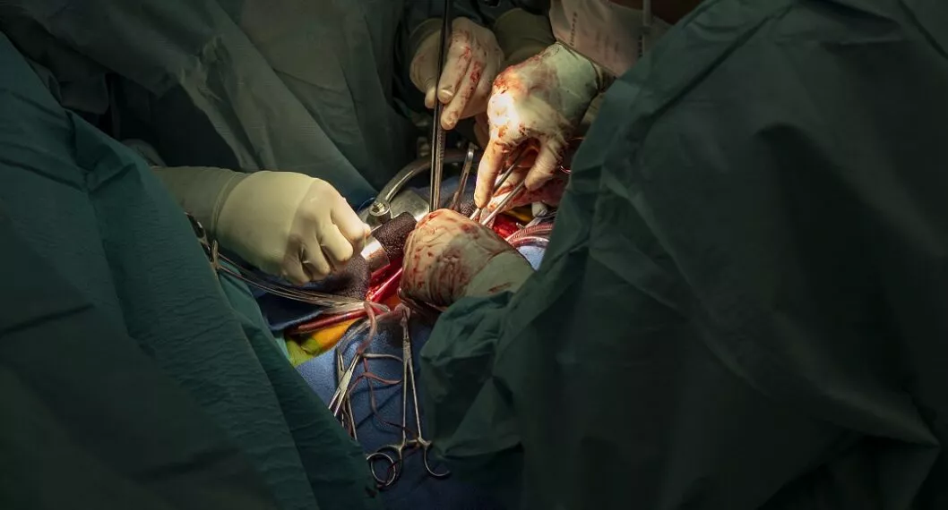 Imagen de operación de corazón ilustra artículo Trasplantan con éxito el corazón de un cerdo a un humano