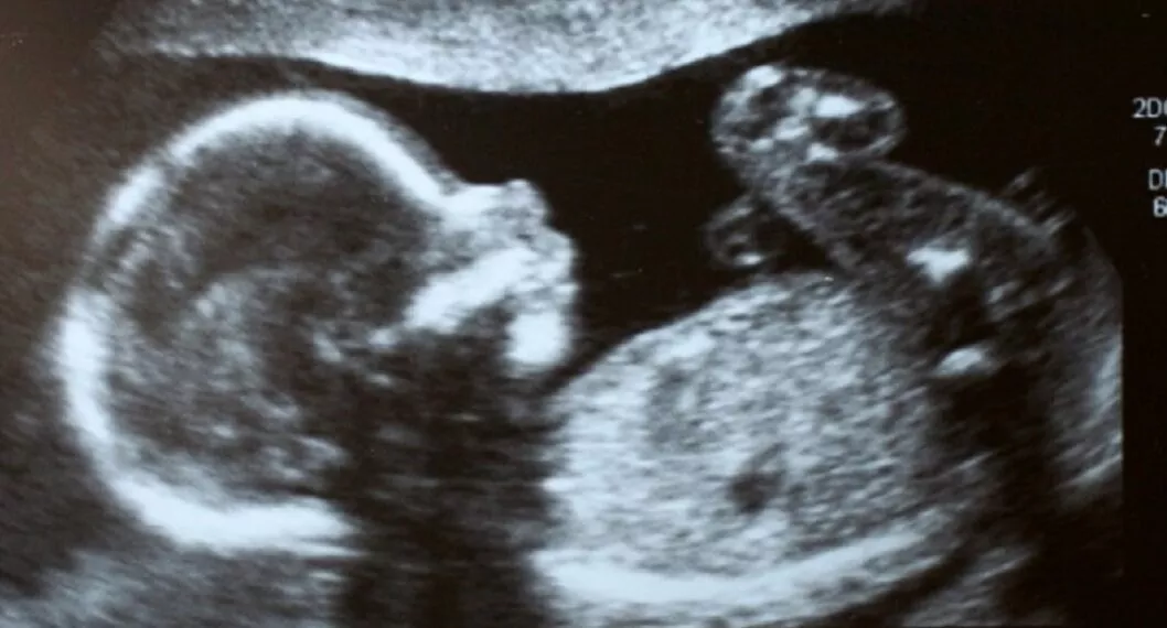 Imagen de una ecografía de un bebé a propósito de los servicios de aborto que ofrecen en Teusaquillo, en Bogotá