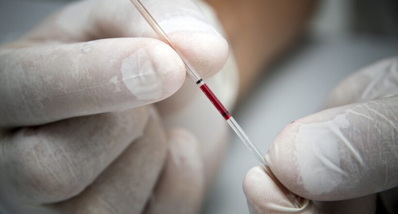 Imagen de muestra de sangre ilustra artículo Nueva variante de VIH no alarma, pero enseña que habría COVID-19 para rato