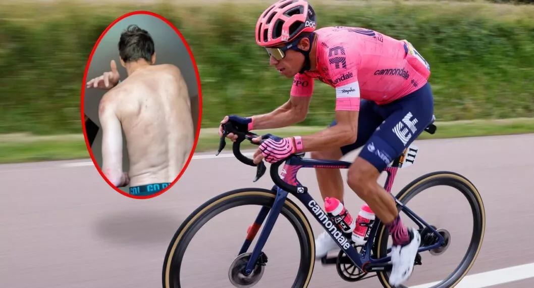 Qué le pasó a Rigoberto Urán en la caída en el Tour de Romandía y video en el que está muy preocupado.