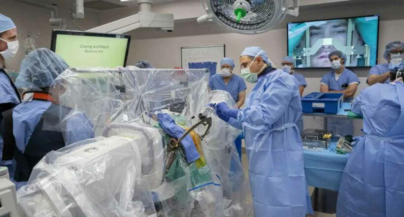 Imagen de médicos en una sala de cirugía a propósito de que la Azúcar humana sirve de combustible para procedimientos de implantes médicos