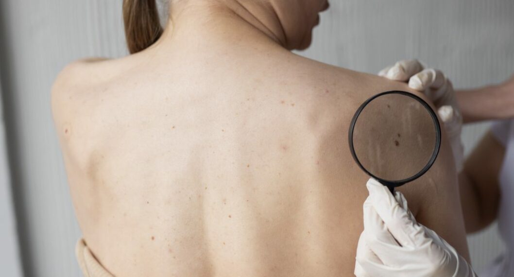 Imagen de una mujer en el médico a propósito de qué es el melanoma, un cáncer que cobra muchas vidas en Colombia y el mundo