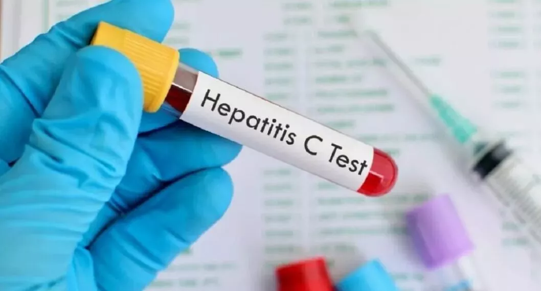 Colombia confirmó segundo caso de hepatitis aguda infantil