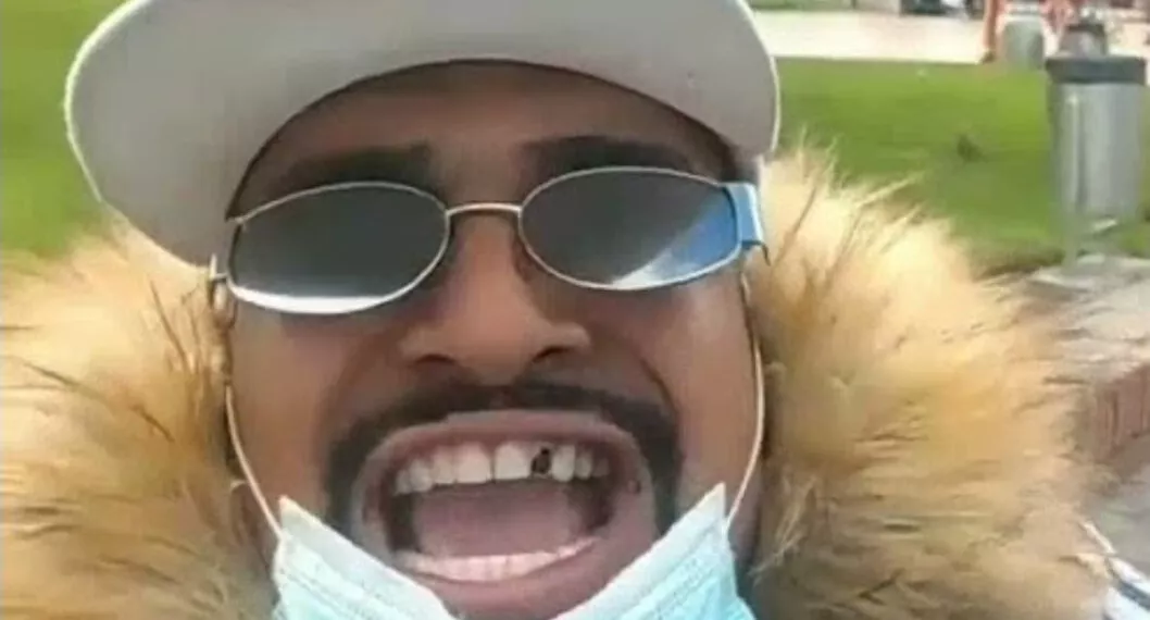 "Por la pega": 'Estiwar G', de Masterchef, contó la historia de por qué no tiene un diente