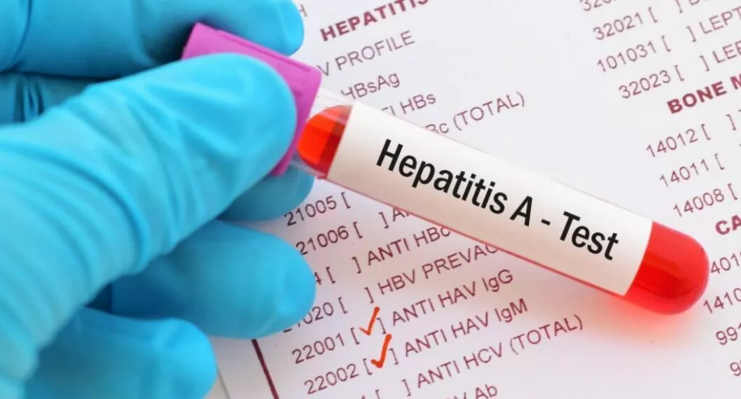 ¿Cómo prevenir la hepatitis?
