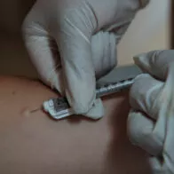 La aplicación de la vacuna contra la viruela del mono, que llegará a Colombia.