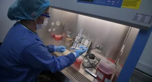 Viruela símica: Cundinamarca procesará pruebas de 14 departamentos del país