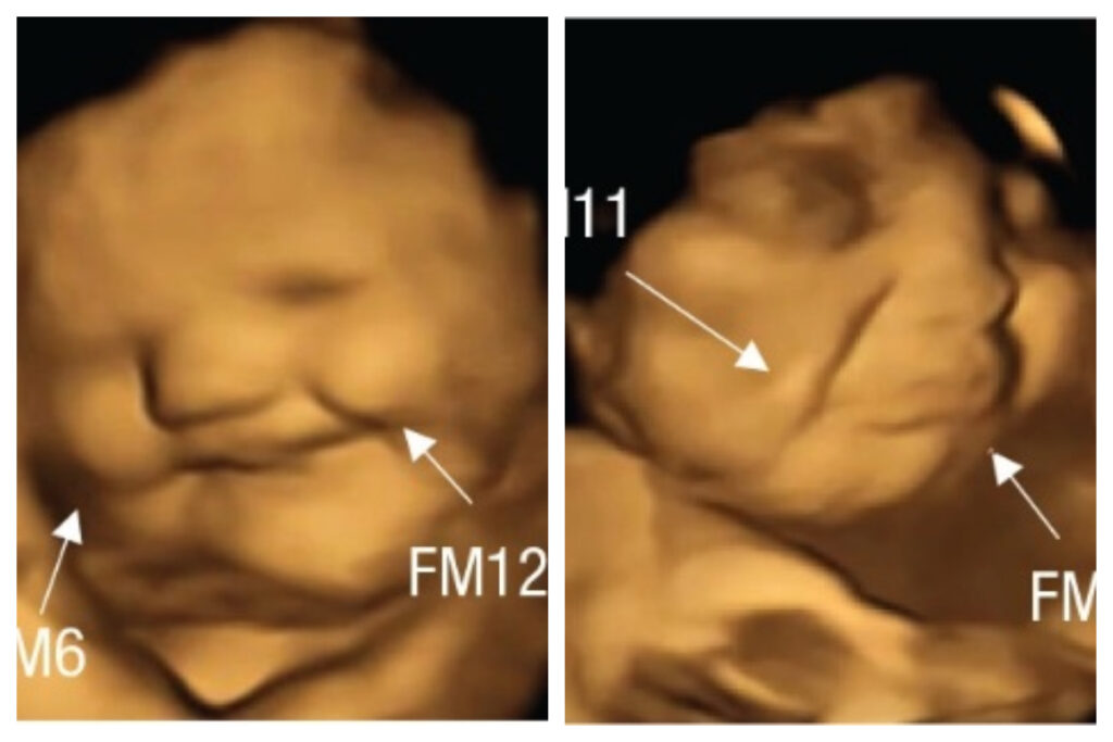 En la primera imagen el feto reacciona con una sorisa al sabor de la zanahoria, y en la segunda reacciona con desagrado a la col rizada/ Psychological Science. 