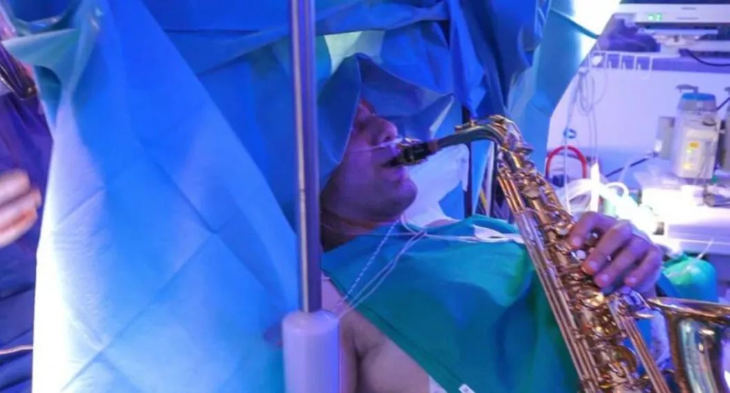 Un músico tocó su saxofón mientras le extirpaban un tumor cerebral, el complejo procedimiento duró cerca de 9 horas y contó con 10 profesionales.