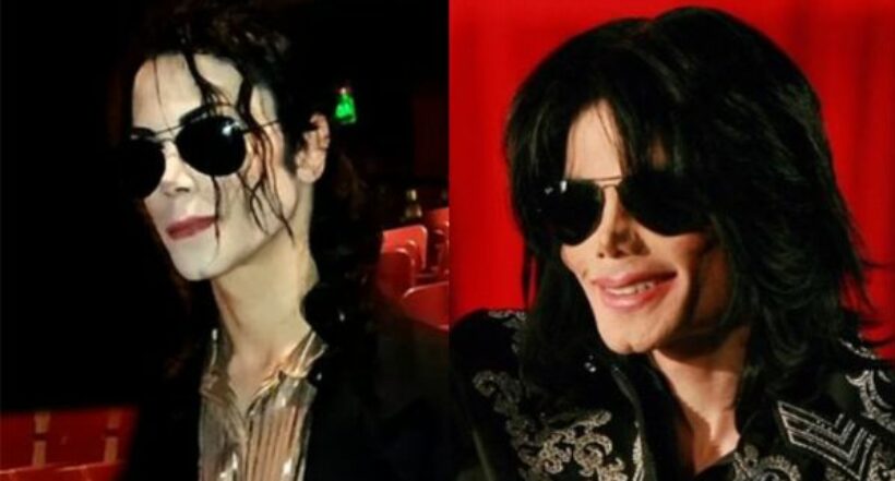 ¿Se parecen? Este joven se hizo 13 cirugías para verse como Michael Jackson