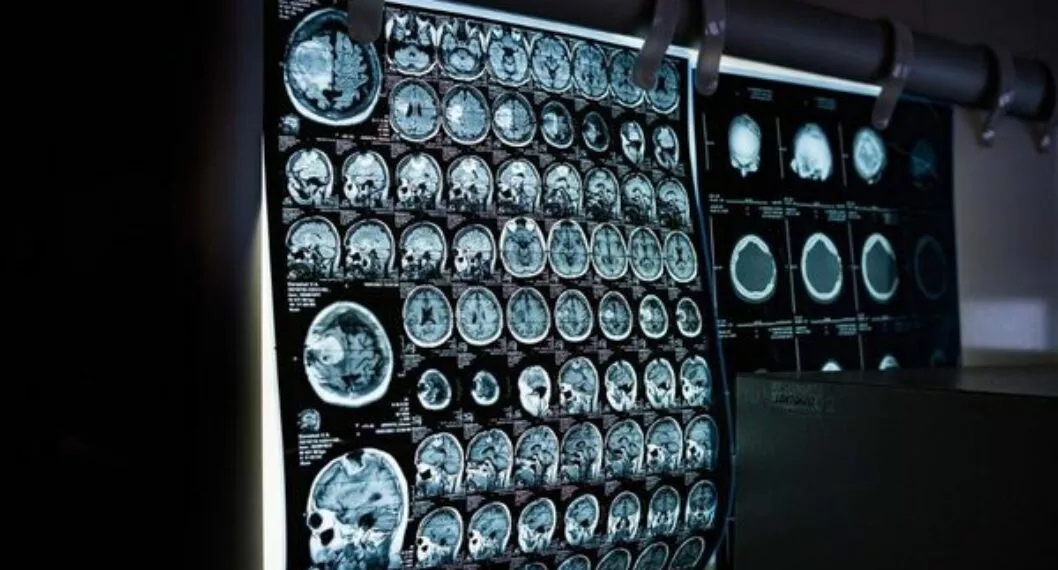 Imagen de una tomografía, a propósito de cómo guarda el cerebro sus memorias mientras duerme, según científicos