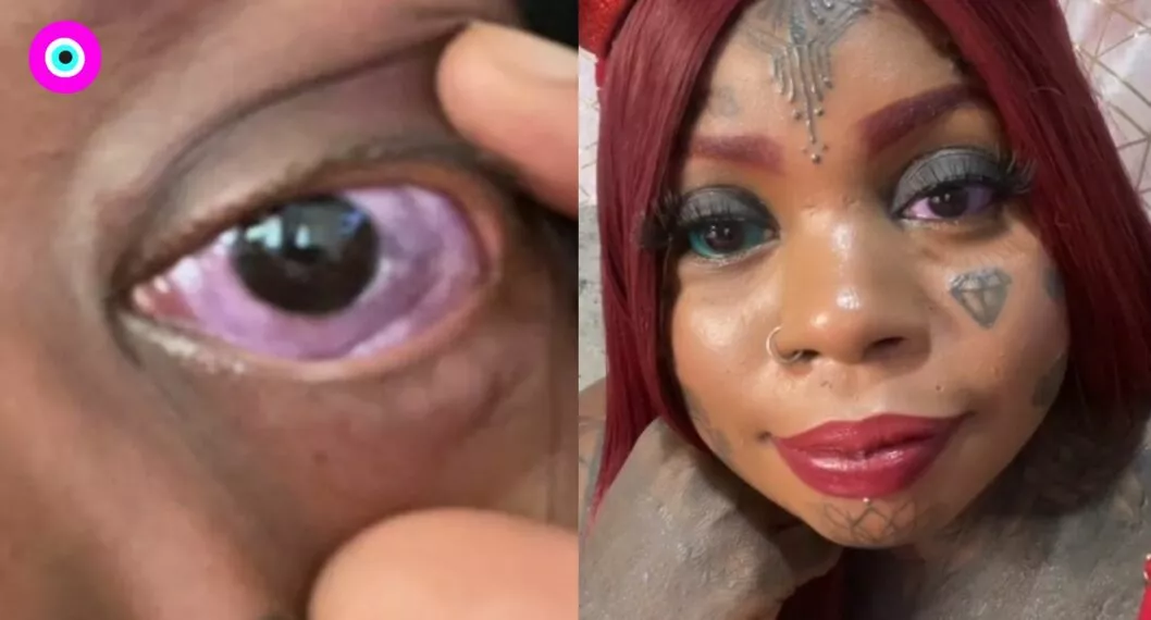 Mujer se tatuó los ojos y ahora se está quedando ciega