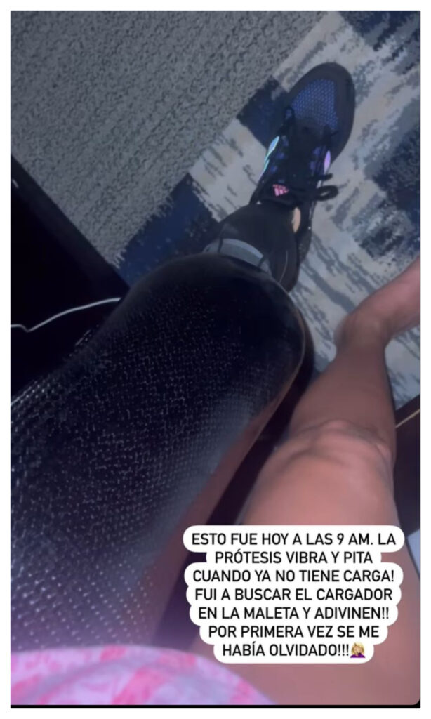 Daniella Álvarez tuvo problema con su prótesis en Miami / Foto: Instagram @danielaalvareztv