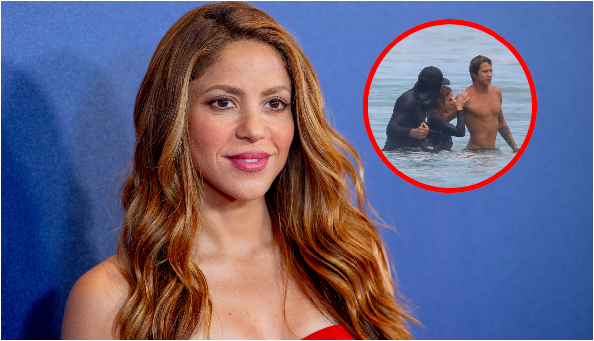 Shakira, a propósito de la caída que sufrió surfeando y que le dejó gran morado un su pierna.
