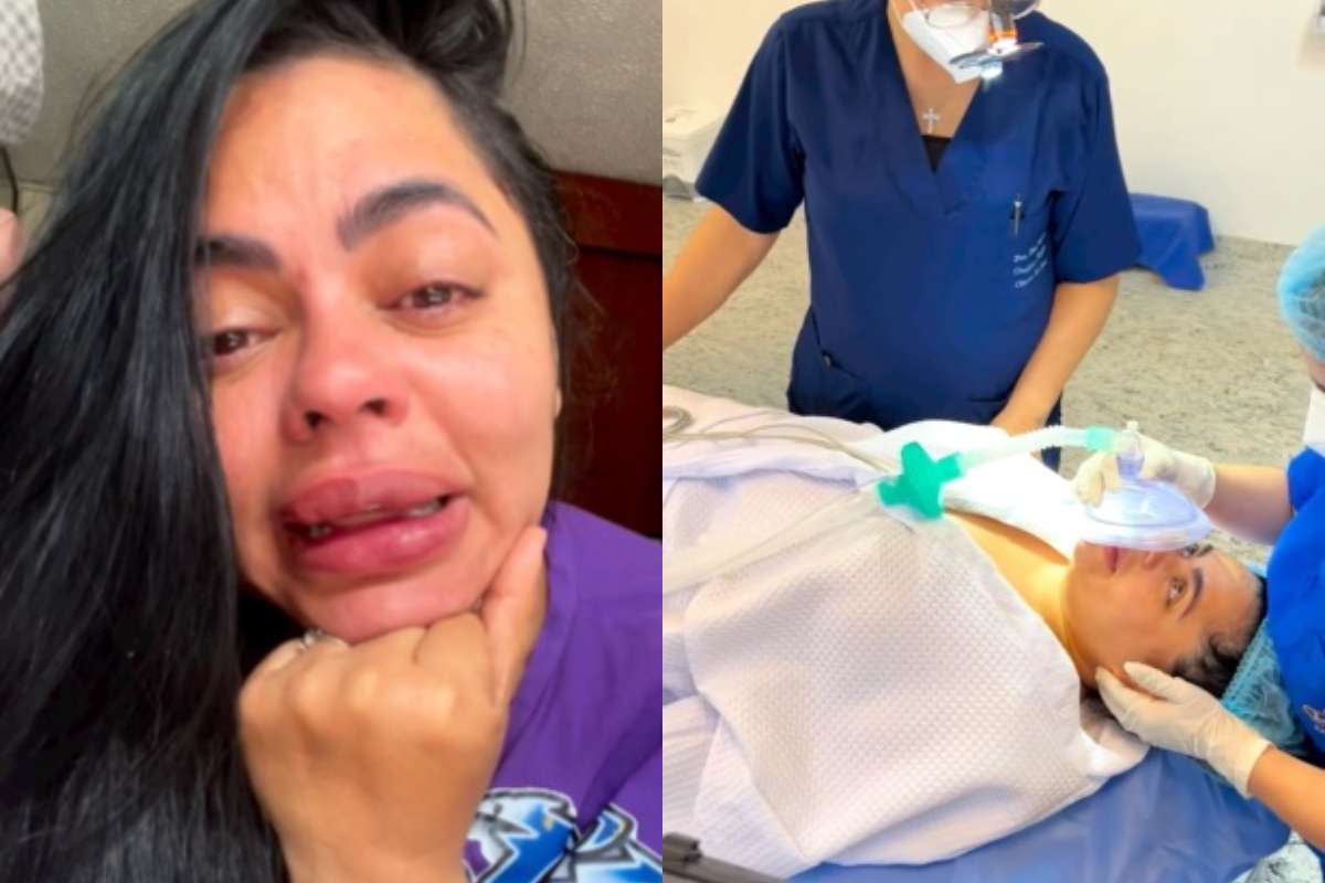 Fotos de Koral Costa, en nota de que la actriz mostró cirugía para sacarle biopolímeros de boca y relató: así quedó