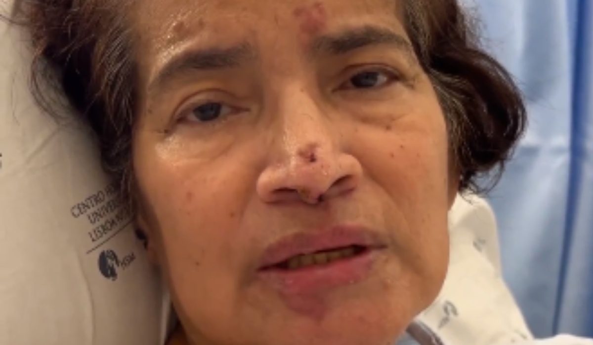 Colombiana hospitalizada en Portugal sufrirá amputaciones: envió fuerte mensaje