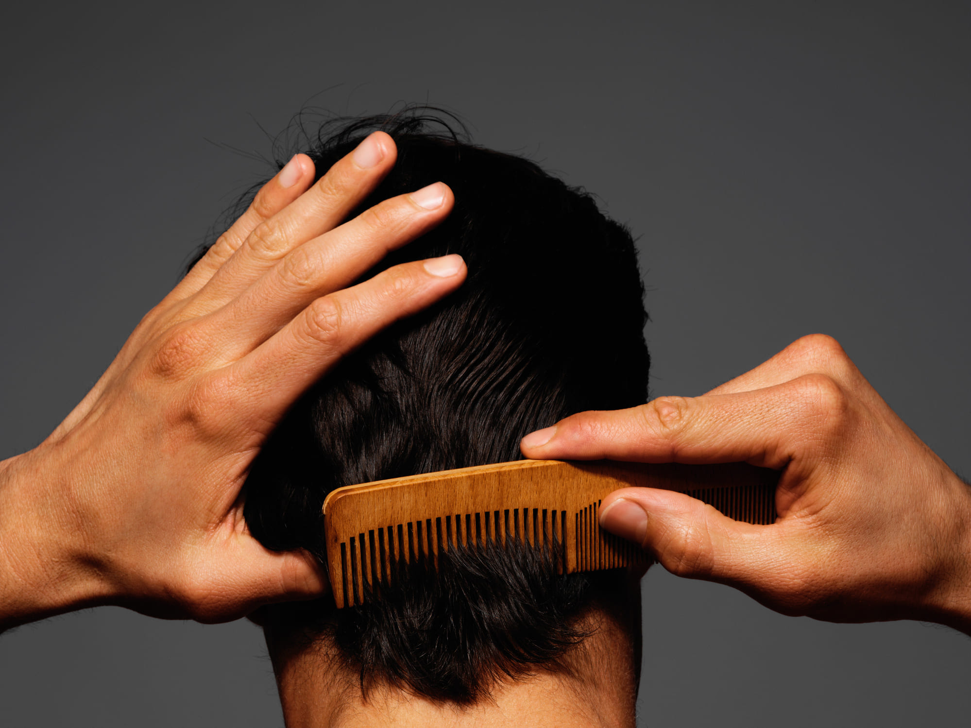 La caída del cabello, se produce por diversas razones la falta de vitamina podría ser una de las más importantes.