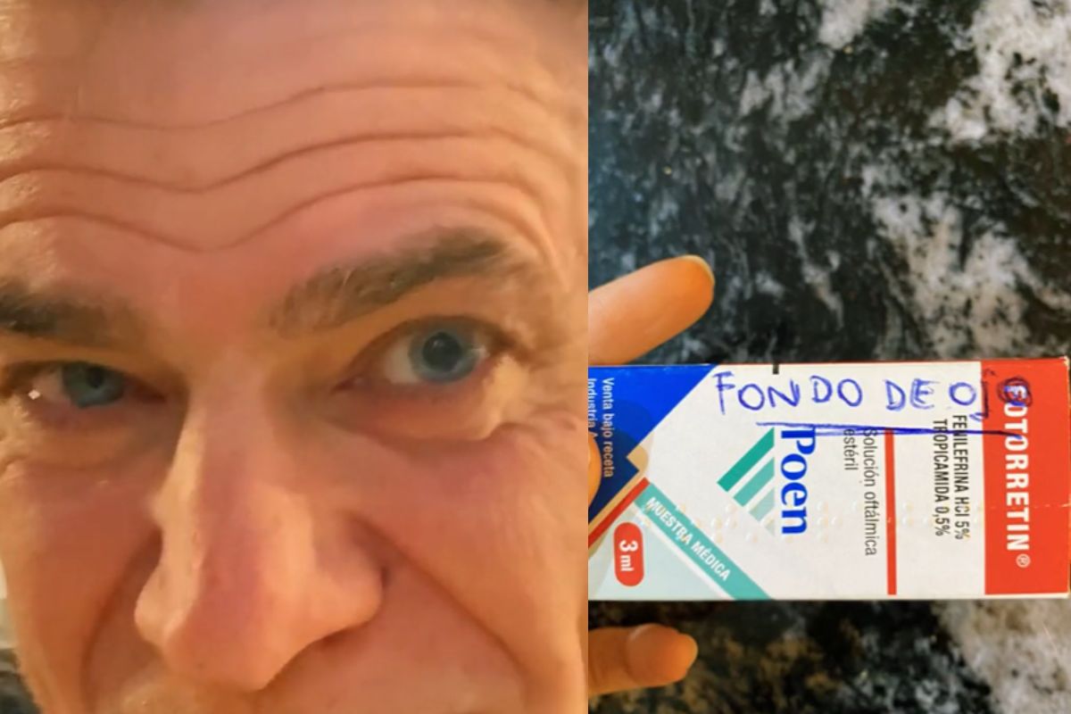 Hombre se aplicó peligroso medicamento en los ojos y se volvió viral en TIkTok 