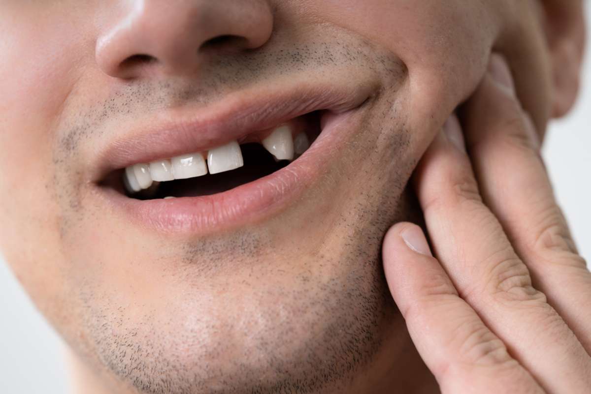 Foto de persona sin diente, en nota de cómo es la periodontitis en Colombia: lío afecta a más de 11 millones de personas