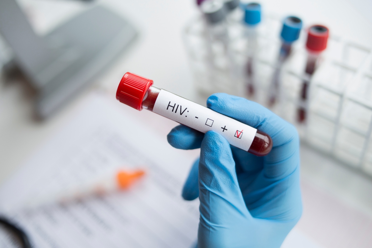 Tres mujeres se contagian de VIH por tratamientos faciales ‘vampiro’