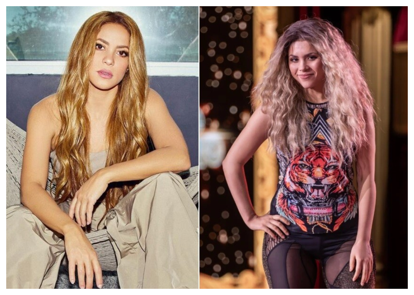Shakira de 'Yo me llamo' de Caracol Televisión, se sometió a cirugía estética