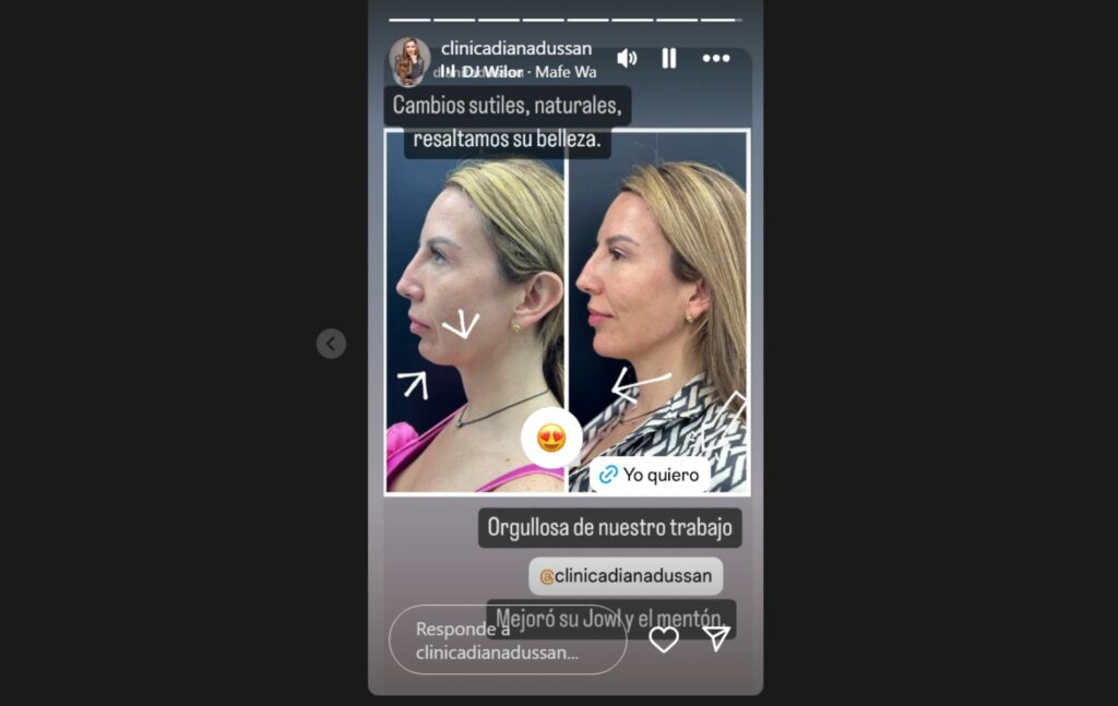 El cambo sutil al que se sometió 'Mafe' Walker. Foto: Instagram