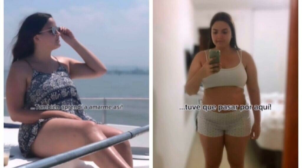 Así era Daniela Toloza antes de la cirugía.