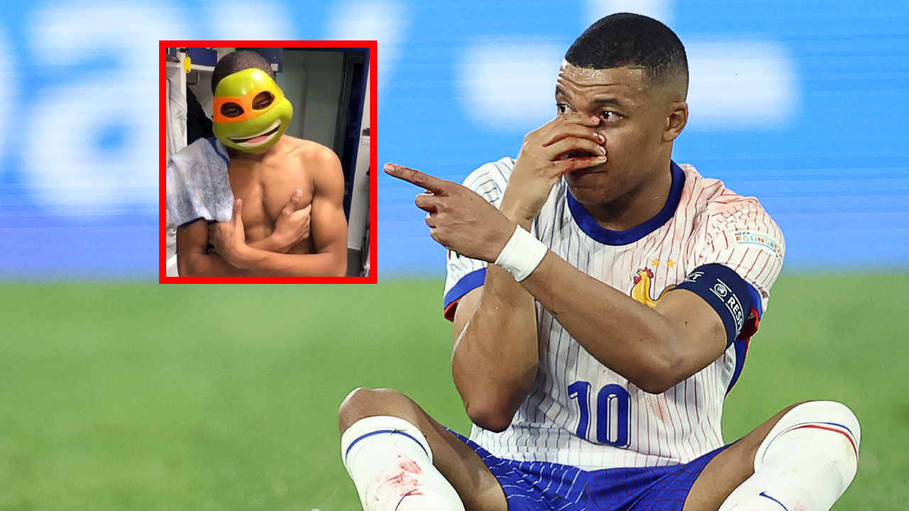 Memes de Kylian Mbappé por fractura de nariz en partido de Francia contra Austria: fotos y videos