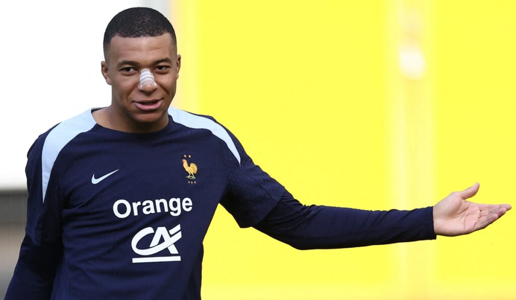 Foto de Kylian Mbappé luego de sufrir golpe en la nariz /Foto: AFP.