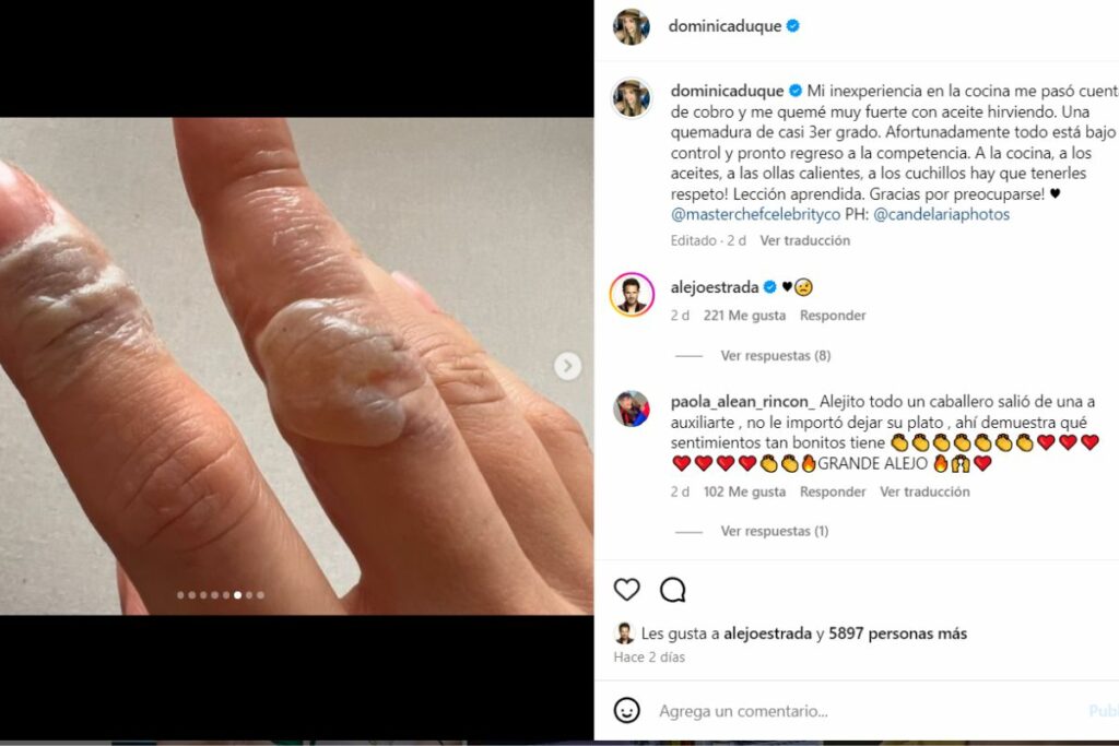 Dominica tuvo quemadura de tercer grado en 'Masterchef Celebrity Colombia'